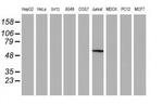 GBA3 Antibody in Western Blot (WB)