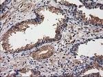 Destrin Antibody in Immunohistochemistry (Paraffin) (IHC (P))