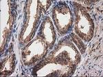 Destrin Antibody in Immunohistochemistry (Paraffin) (IHC (P))