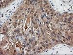 Destrin Antibody in Immunohistochemistry (Paraffin) (IHC (P))