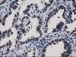 HDHD1 Antibody in Immunohistochemistry (Paraffin) (IHC (P))