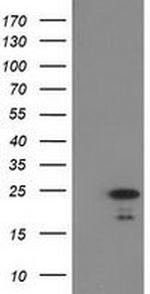 HDHD1 Antibody in Western Blot (WB)