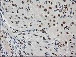 MEF2C Antibody in Immunohistochemistry (Paraffin) (IHC (P))