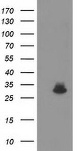 KCTD14 Antibody in Western Blot (WB)