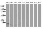 NDUFA7 Antibody in Western Blot (WB)