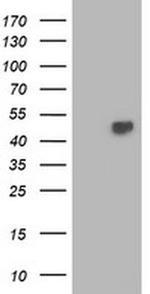 TBCEL Antibody in Western Blot (WB)