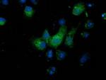 MGRN1 Antibody in Immunocytochemistry (ICC/IF)