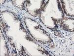 GUK1 Antibody in Immunohistochemistry (Paraffin) (IHC (P))