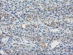 GUK1 Antibody in Immunohistochemistry (Paraffin) (IHC (P))