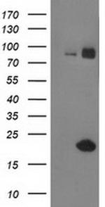 GUK1 Antibody in Western Blot (WB)