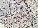 DCK Antibody in Immunohistochemistry (Paraffin) (IHC (P))