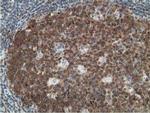 DCK Antibody in Immunohistochemistry (Paraffin) (IHC (P))