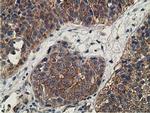 CCNB1IP1 Antibody in Immunohistochemistry (Paraffin) (IHC (P))