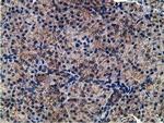 CCNB1IP1 Antibody in Immunohistochemistry (Paraffin) (IHC (P))