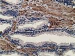 CCNB1IP1 Antibody in Immunohistochemistry (Paraffin) (IHC (P))