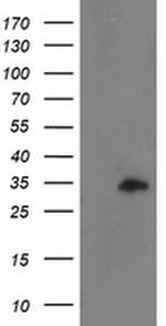 CCNB1IP1 Antibody in Western Blot (WB)