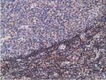 PDLIM2 Antibody in Immunohistochemistry (Paraffin) (IHC (P))