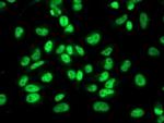 RBP1 Antibody in Immunocytochemistry (ICC/IF)