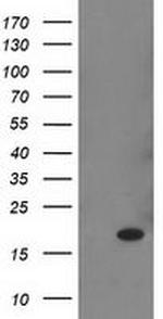 RBP1 Antibody in Western Blot (WB)