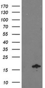 NDUFA7 Antibody in Western Blot (WB)