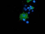 LNK Antibody in Immunocytochemistry (ICC/IF)