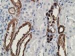 LNK Antibody in Immunohistochemistry (Paraffin) (IHC (P))