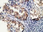 LNK Antibody in Immunohistochemistry (Paraffin) (IHC (P))