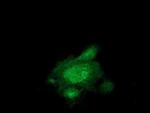 MAPRE2 Antibody in Immunocytochemistry (ICC/IF)