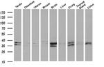 MAPRE2 Antibody in Western Blot (WB)