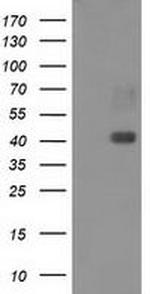 MAPRE2 Antibody in Western Blot (WB)