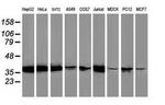 MAPRE2 Antibody in Western Blot (WB)