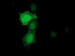 PNMT Antibody in Immunocytochemistry (ICC/IF)