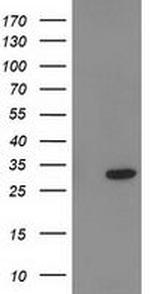 PNMT Antibody in Western Blot (WB)