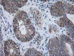 RBP1 Antibody in Immunohistochemistry (Paraffin) (IHC (P))