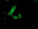 Monoacylglycerol Lipase Antibody in Immunocytochemistry (ICC/IF)