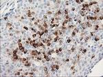 Monoacylglycerol Lipase Antibody in Immunohistochemistry (Paraffin) (IHC (P))