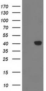 Monoacylglycerol Lipase Antibody in Western Blot (WB)