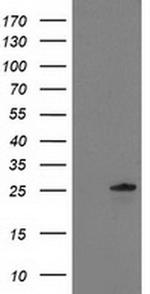 C1orf50 Antibody in Western Blot (WB)