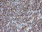 Monoacylglycerol Lipase Antibody in Immunohistochemistry (Paraffin) (IHC (P))