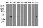 MVK Antibody in Western Blot (WB)