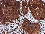 C1orf50 Antibody in Immunohistochemistry (Paraffin) (IHC (P))