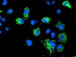 Adenylate Kinase 4 Antibody in Immunocytochemistry (ICC/IF)