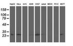 Adenylate Kinase 4 Antibody in Western Blot (WB)