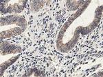 LGR5 Antibody in Immunohistochemistry (Paraffin) (IHC (P))