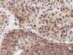 LGR5 Antibody in Immunohistochemistry (Paraffin) (IHC (P))