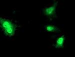 FGF21 Antibody in Immunocytochemistry (ICC/IF)