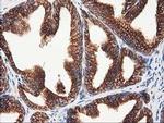 beta-4 Tubulin Antibody in Immunohistochemistry (Paraffin) (IHC (P))