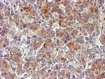 NDUFAF7 Antibody in Immunohistochemistry (Paraffin) (IHC (P))