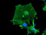 LIMK1 Antibody in Immunocytochemistry (ICC/IF)