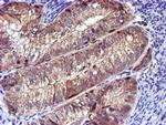 LIMK1 Antibody in Immunohistochemistry (Paraffin) (IHC (P))